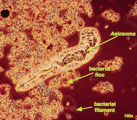 Aeolosoma bristle worm among bacterial floc and filaments, labeled, phase contrast at 100x