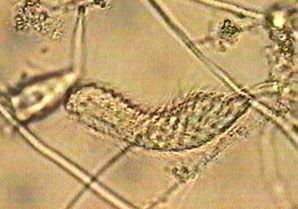 Chaetonotus, a small ciliated gastrotrich, among filaments
