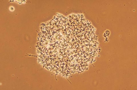 Round, compact floc with only a few short filaments and a clear background, phase contrast