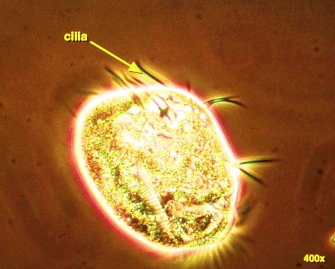 Oval crawling ciliate with its cirri (tufts of fused cilia, labeled cilia), phase contrast at 400x