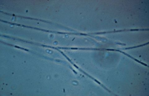 Sphaerotilus natans filaments with gaps from cell damage