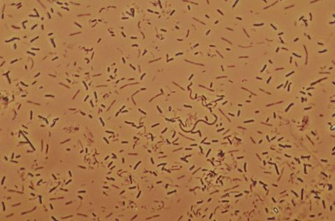 Field of single rod shaped bacteria with no floc