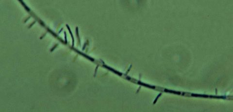 Filament with broken, damaged cells after chlorination, 400x