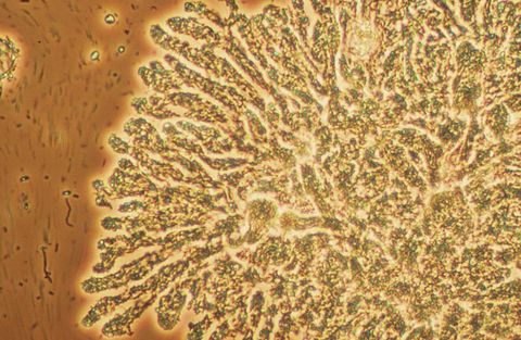 Fingered Zoogloea growth with finger like projections, 400x