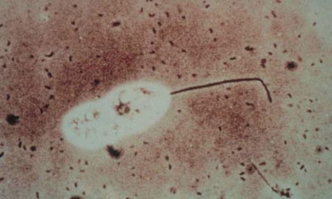 Oval flagellate with one long whip like flagellum among dispersed bacteria, brightfield