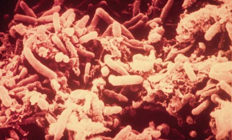 Colorized scanning electron micrograph of rod shaped floc forming bacteria, 7200x