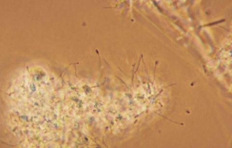 Hyphomicrobium cells with thin hyphae (stalk like extensions) at the edge of a floc