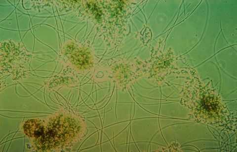 Long filaments bridging between several flocs, 100x