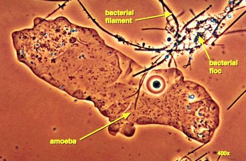 Large naked amoeba next to bacterial floc and a bacterial filament, labeled, phase contrast at 400x