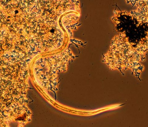 Slender nematode worm moving between flocs, phase contrast