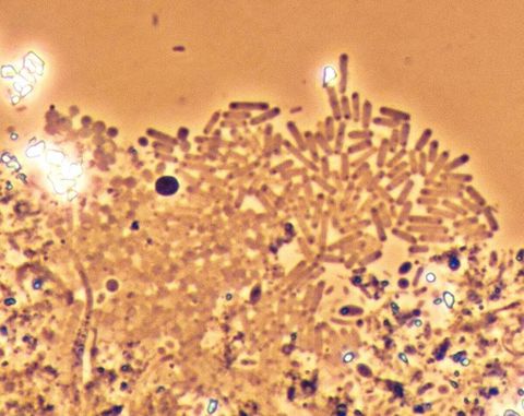 Cluster of rod shaped bacteria at the edge of a floc, shown on the teaching slide as nitrifying bacteria, phase contrast