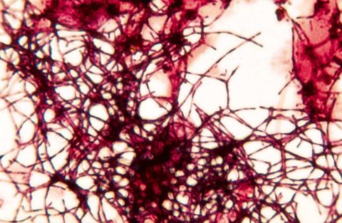 Branched Gram positive nocardioform filaments, purple, at 1000x