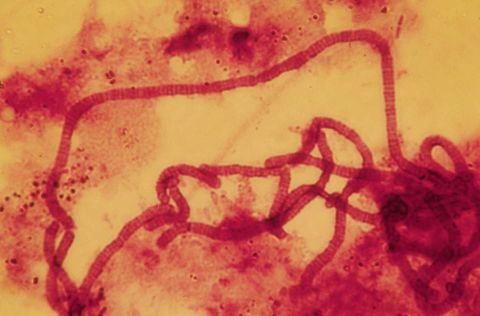 Coiled Nostocoida limicola II filament with disc shaped cells, stained, 1000x