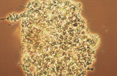 Large open floc with dispersed cells and a few filaments, phase contrast