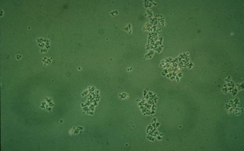 Small, scattered pin floc particles on a hazy background