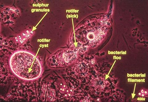 Sick rotifer and a rotifer cyst among sulfur granules, bacterial floc and a filament, labeled, phase contrast at 400x