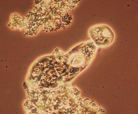 Rotifer anchored to a floc, with another floc at its head end, phase contrast at 400x