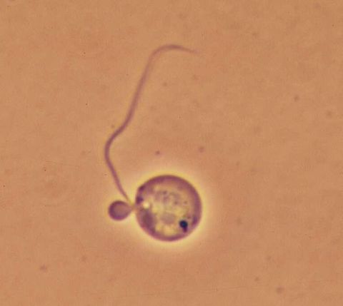 Small round flagellate with one flagellum, brightfield