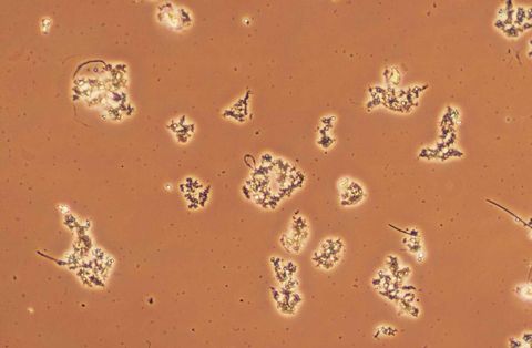 Many small, irregular flocs on a clear background, phase contrast at low power