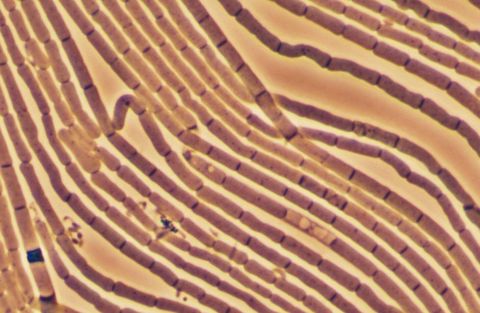 Parallel Sphaerotilus natans filaments with visible cells in a sheath, phase contrast at 1000x