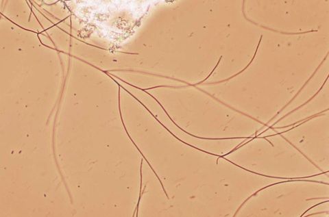 Long, sheathed Sphaerotilus natans filaments with false branching, 200x