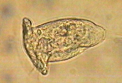 Single vase shaped stalked ciliate in brightfield