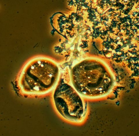 Three bell shaped stalked ciliates on the edge of a floc, phase contrast