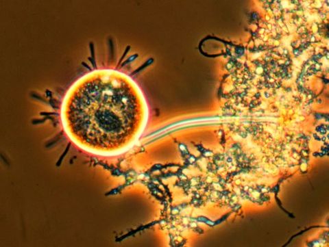 Round suctorian with tentacles attached to a floc, phase contrast