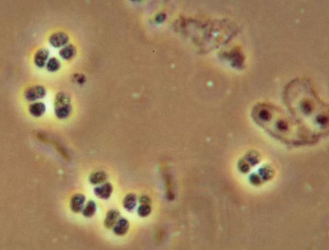 Groups of four round cells (tetrads), phase contrast