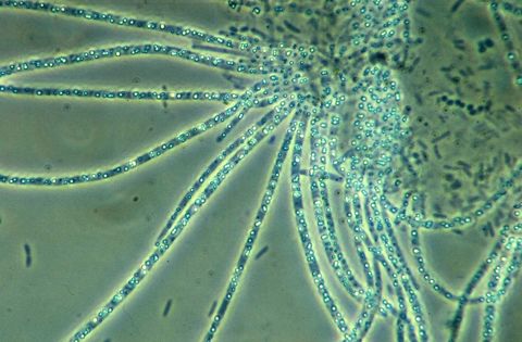 Thiothrix filaments radiating from a floc in a rosette, sulfur granules visible, phase contrast at 1000x