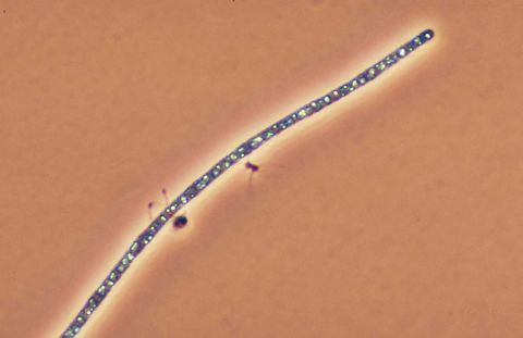 Straight Thiothrix I filament with sulfur granules, phase contrast
