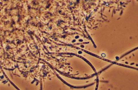 Thiothrix II filaments damaged by chlorine among floc, 1000x