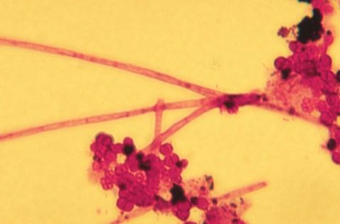 Type 0041 filament with attached growth, staining pink (Gram negative) on this slide, 1000x