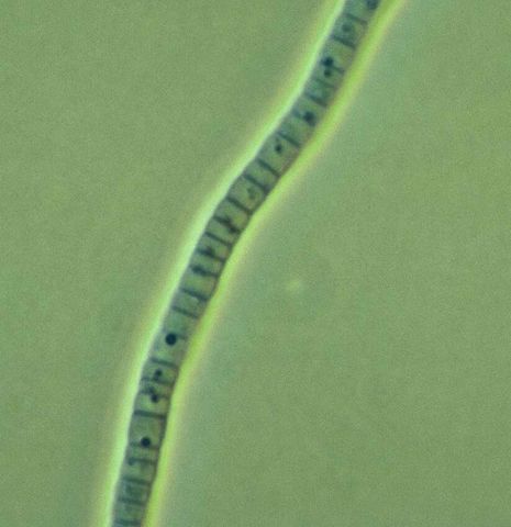 Single Type 021N filament with distinct cells, phase contrast at 1000x