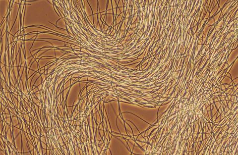 Dense mat of Type 021N filaments, phase contrast at 200x