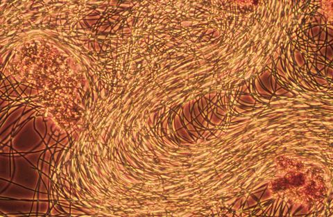 Massive Type 021N growth around floc, phase contrast